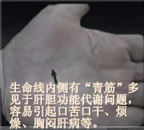 人体体表“青筋”凸起意味着什么? 
