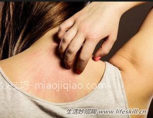 冬季痒是怎么回事？又怎样解决？ 